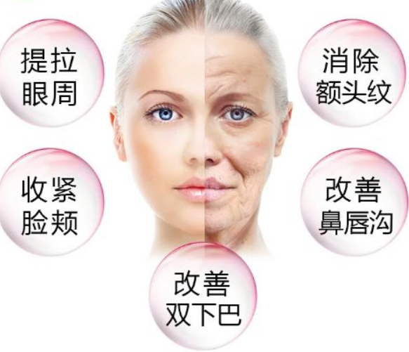 微创提升面部*果怎样?面部拉皮术后什么时候