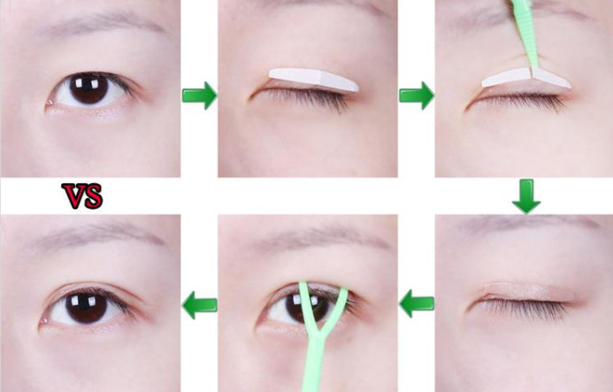 想要双眼皮?三个方法帮你甩掉肿眼泡