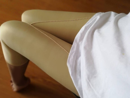 在深圳广和做了大腿吸脂,今天第28天了