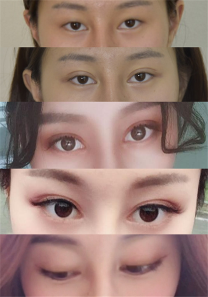 在广州华美找阮庆玲做的*,很喜欢现在的