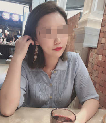 在杭州华山连天美做的磨骨,*果很好