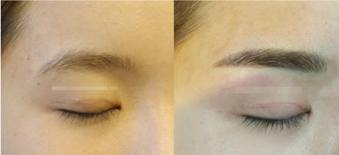 半**纹眉 半**纹眉