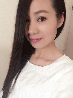 全切加开内眼角,恢复后整个气质up!