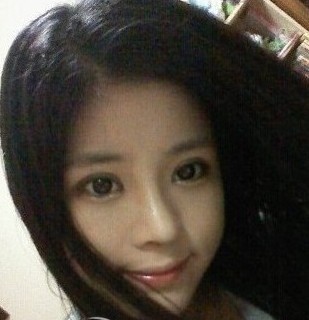 隆鼻+开眼角+韩式微切双眼皮,让我距离完美更近