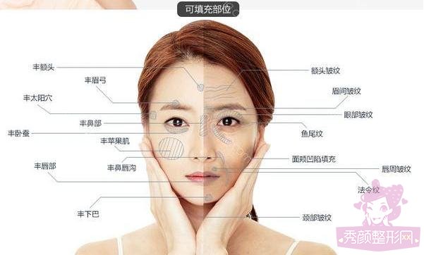 全脸自体脂肪填充大概多少钱