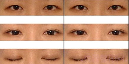 上海九院整形价格表2021整容价目