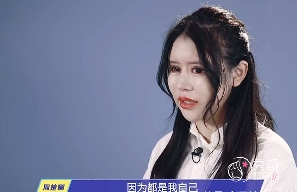 花费400万15岁网红女孩周楚娜整容数百次!