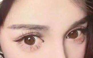 北京燕郊割双眼皮手术的要素有哪几方面?