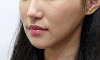 鞍山张玉霞医疗美容机构 价格表权威一览 鞍山张玉霞医疗美容机构 价格表权威一览