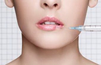 玻尿酸丰唇珠收费标准_具体多少钱? 玻尿酸丰唇珠收费标准_具体多少钱?