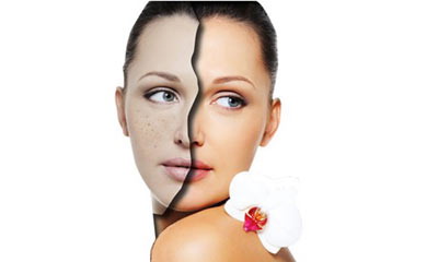 济南激光祛斑整形专家哪个技术好?