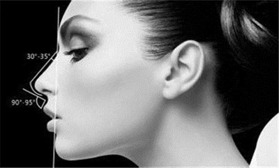 注射隆鼻价格参考_具体多少钱? 注射隆鼻价格参考_具体多少钱?