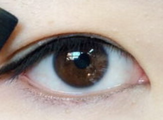 溶脂去眼袋优惠价格,一般要多少钱? 溶脂去眼袋优惠价格,一般要多少钱?