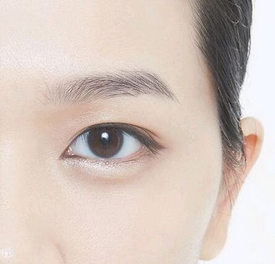 溶脂去眼袋收费标准_大概要多少钱?