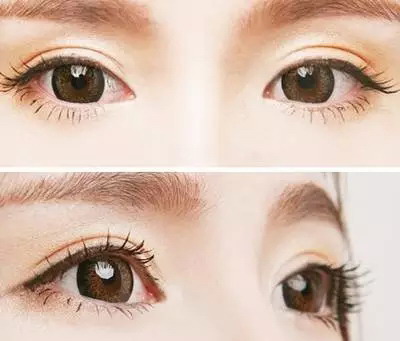 溶脂去眼袋收费价目表_大概需要多少钱? 溶脂去眼袋收费价目表_大概需要多少钱?