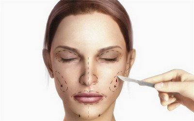 彩光祛斑收费明细,大约要花多少钱? 彩光祛斑收费明细,大约要花多少钱?