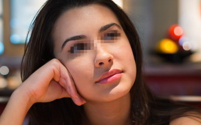 彩光祛斑一般需要多少钱? 彩光祛斑一般需要多少钱?