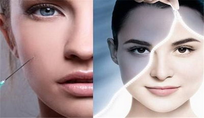 玻尿酸注射填充去痘疤活动优惠价格_大概多少钱?