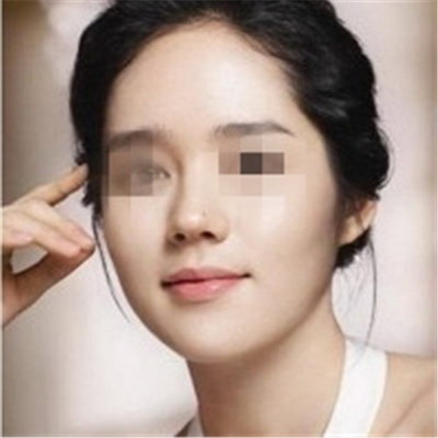 注射隆鼻价格一览表,大概要花多少钱? 注射隆鼻价格一览表,大概要花多少钱?