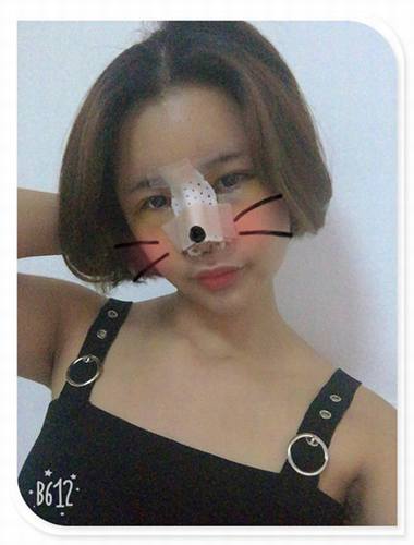 国庆8天长假来啦!亲们怎么打算呢?亲爱的小主你准备好趁这段时间整形了吗?已经有妹子怕国庆人多!赶在国庆前做啦!哈哈~~