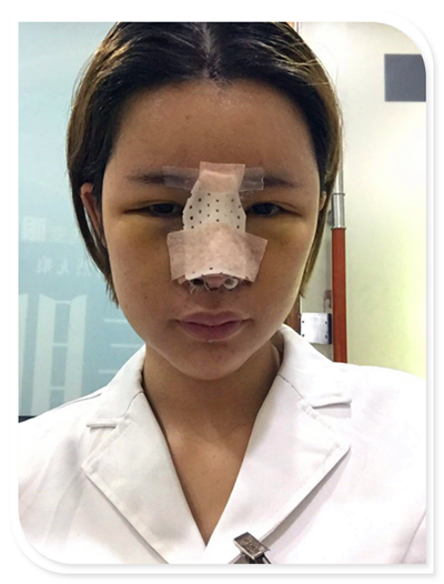 国庆8天长假来啦!亲们怎么打算呢?亲爱的小主你准备好趁这段时间整形了吗?已经有妹子怕国庆人多!赶在国庆前做啦!哈哈~~