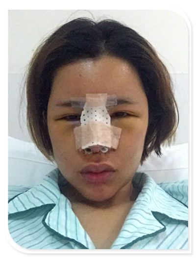 国庆8天长假来啦!亲们怎么打算呢?亲爱的小主你准备好趁这段时间整形了吗?已经有妹子怕国庆人多!赶在国庆前做啦!哈哈~~