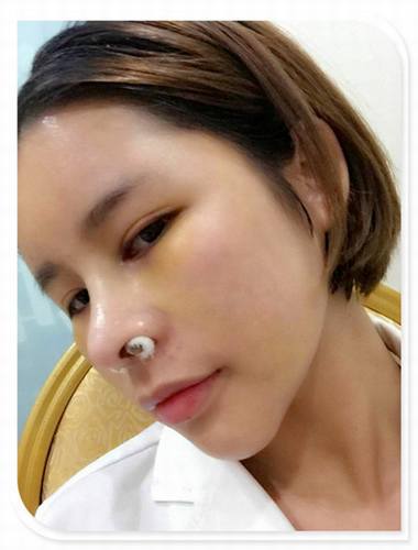 国庆8天长假来啦!亲们怎么打算呢?亲爱的小主你准备好趁这段时间整形了吗?已经有妹子怕国庆人多!赶在国庆前做啦!哈哈~~