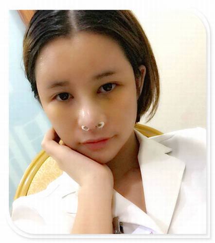 国庆8天长假来啦!亲们怎么打算呢?亲爱的小主你准备好趁这段时间整形了吗?已经有妹子怕国庆人多!赶在国庆前做啦!哈哈~~