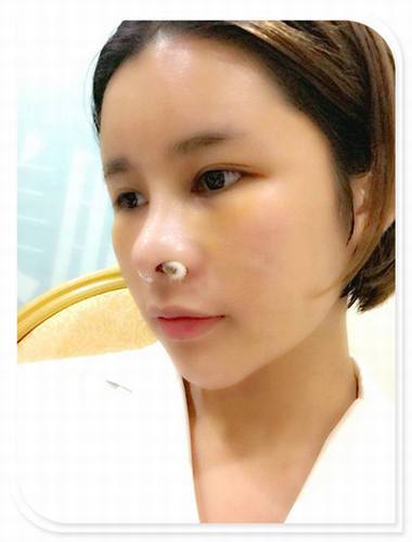 国庆8天长假来啦!亲们怎么打算呢?亲爱的小主你准备好趁这段时间整形了吗?已经有妹子怕国庆人多!赶在国庆前做啦!哈哈~~