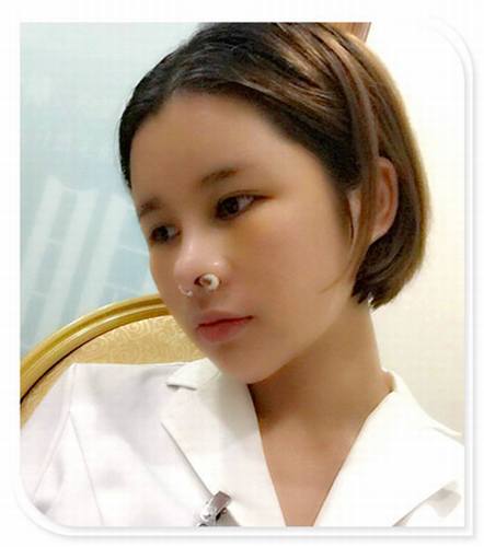 国庆8天长假来啦!亲们怎么打算呢?亲爱的小主你准备好趁这段时间整形了吗?已经有妹子怕国庆人多!赶在国庆前做啦!哈哈~~