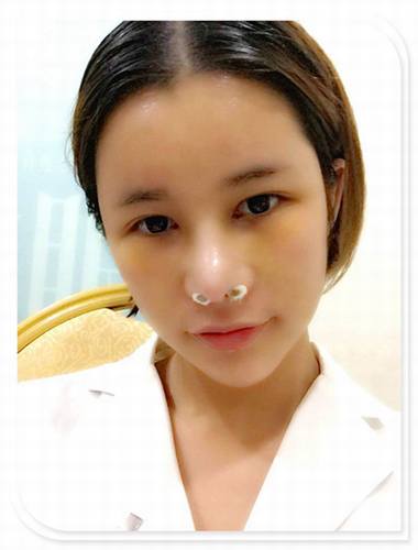 国庆8天长假来啦!亲们怎么打算呢?亲爱的小主你准备好趁这段时间整形了吗?已经有妹子怕国庆人多!赶在国庆前做啦!哈哈~~