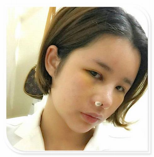 国庆8天长假来啦!亲们怎么打算呢?亲爱的小主你准备好趁这段时间整形了吗?已经有妹子怕国庆人多!赶在国庆前做啦!哈哈~~