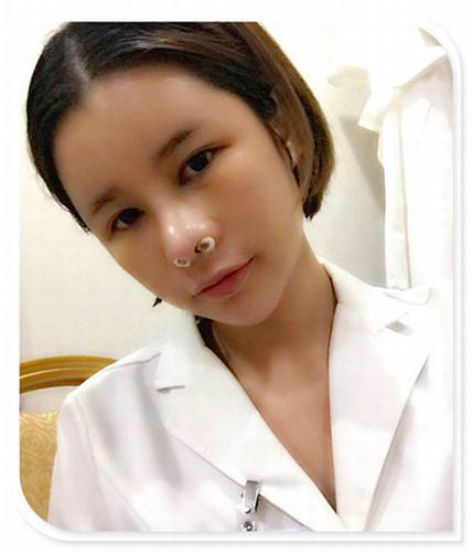 国庆8天长假来啦!亲们怎么打算呢?亲爱的小主你准备好趁这段时间整形了吗?已经有妹子怕国庆人多!赶在国庆前做啦!哈哈~~