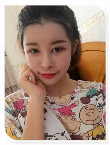 国庆8天长假来啦!亲们怎么打算呢?亲爱的小主你准备好趁这段时间整形了吗?已经有妹子怕国庆人多!赶在国庆前做啦!哈哈~~