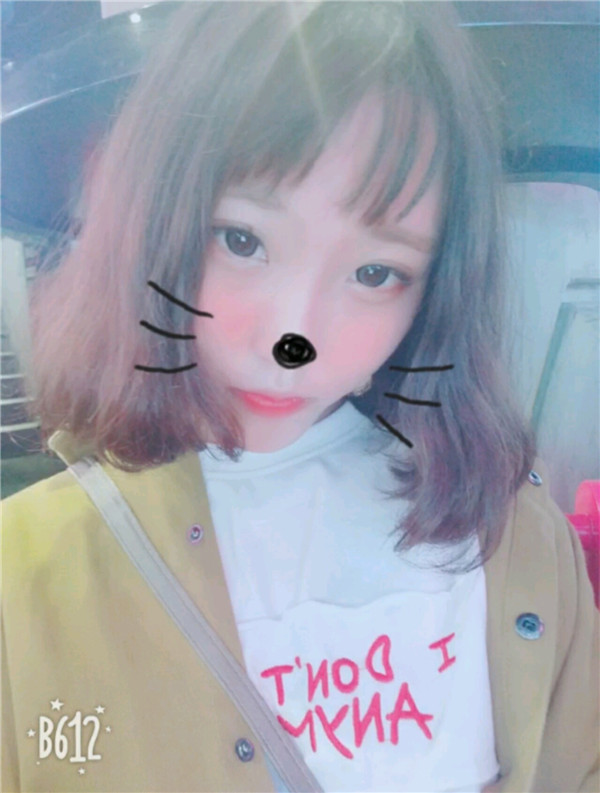 小仙女们，不要做丑女人，要做自己的女神！！双眼皮加苹果肌，一加一等于的果是三哦！速度来围观我的变美案例啦~~~~