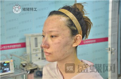 武汉希思特,陈安云,,案例,价格,