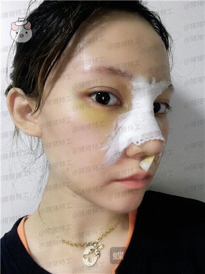 武汉希思特,陈安云,,案例,价格,