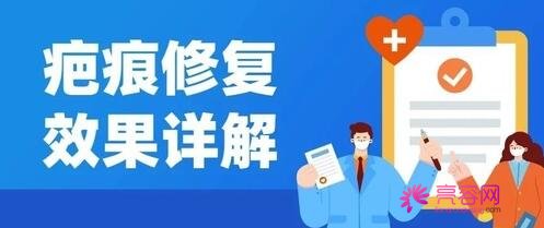 广州市中西医结合医院烧伤整形外科怎么样?医生信息与疤痕修复手术案例