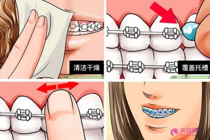 长沙市第四医院口腔科怎么样?2021版价格表|整形专家信息|正畸案例