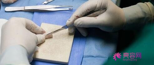 民航广州医院整形外科怎么样?2021版价格表与医生信息