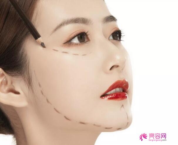 男性过大下颌角整形果好不好?来看手术前后变化:真的值得一做?