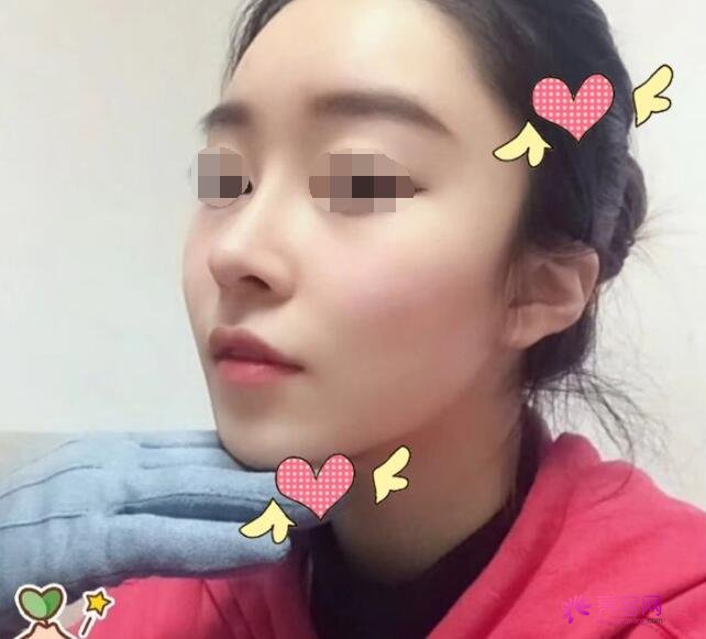 周柯和贾德渊谁做得好?2位大咖医生信息介绍|整形案例分享