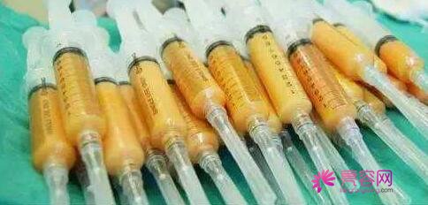 同济冯幼平脂肪填充果好吗?医生综合实力分析+面部脂肪填充案例