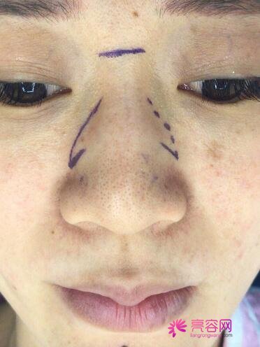 民航广州医院整形外科怎么样?2021版价格表与医生信息