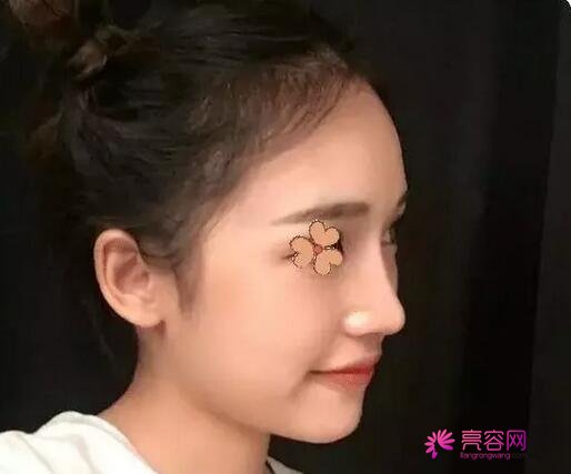 民航广州医院整形外科怎么样?2021版价格表与医生信息