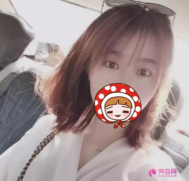 下眼至整形图片对比,秒变无辜眼:想拥有漫画版“小鹿眼”吗?