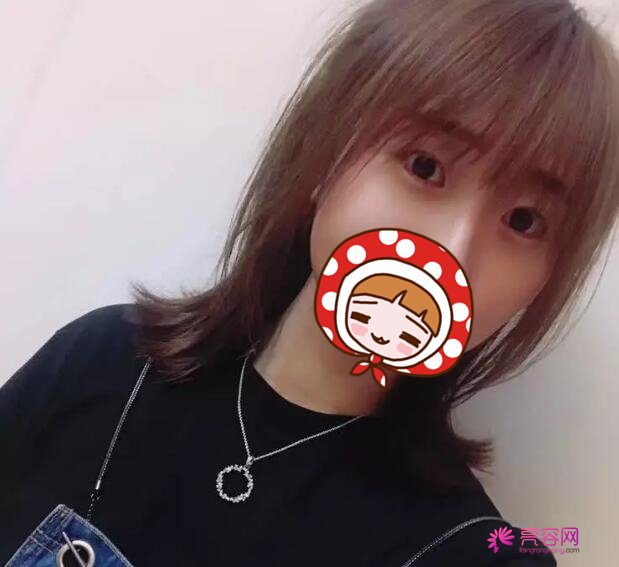 下眼至整形图片对比,秒变无辜眼:想拥有漫画版“小鹿眼”吗?