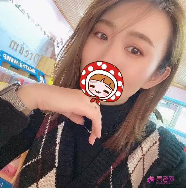 下眼至整形图片对比,秒变无辜眼:想拥有漫画版“小鹿眼”吗?