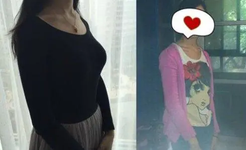 曼托妙桃假体隆胸果好吗?一起来了解一下