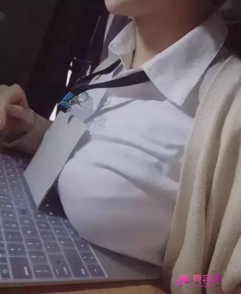 曼托妙桃假体隆胸果好吗?一起来了解一下